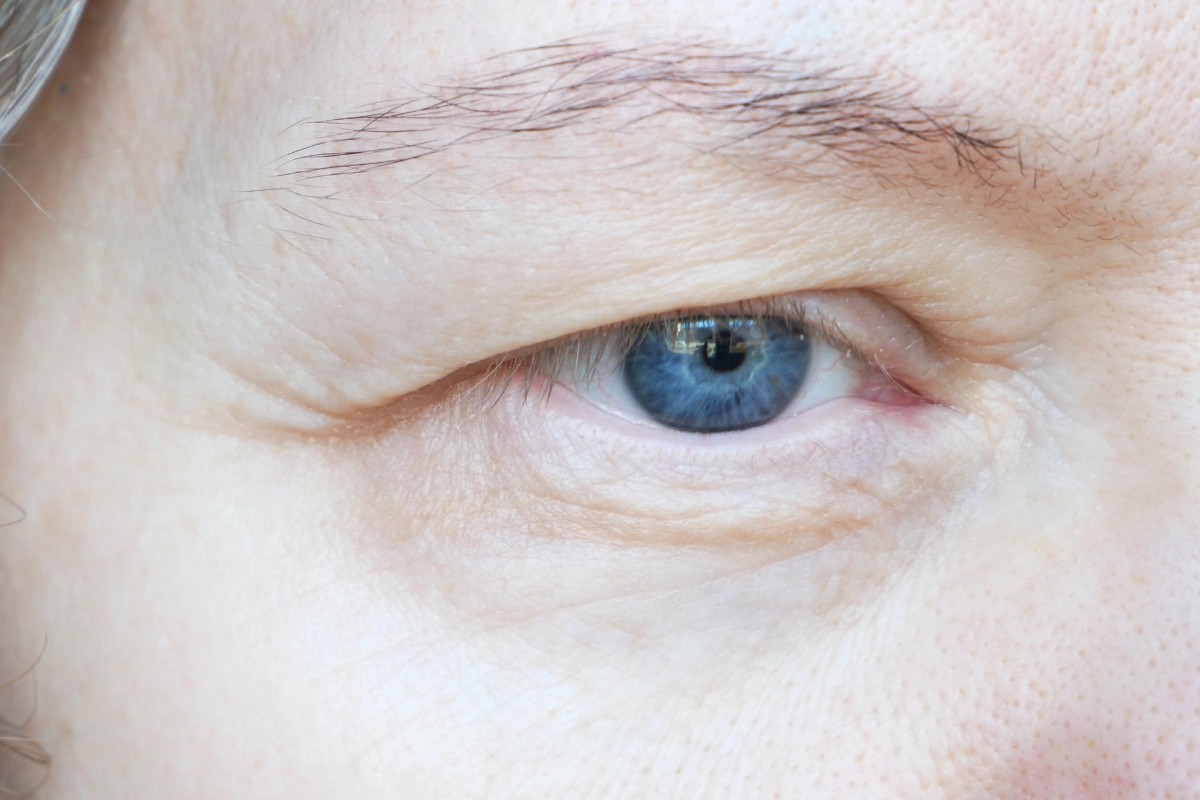 tratamiento de piel debajo de los ojos