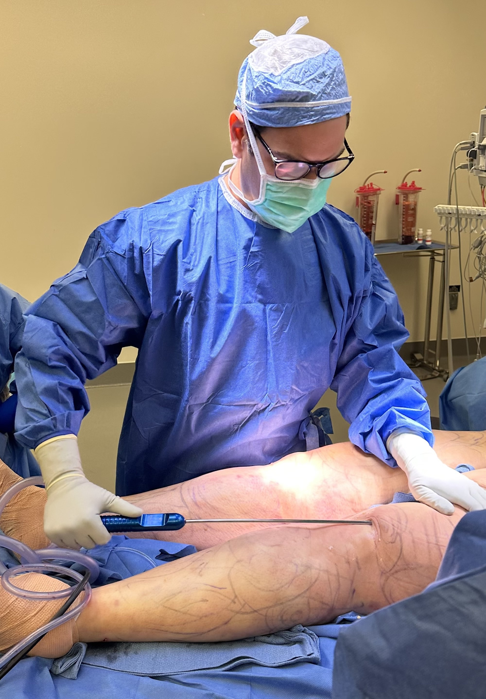 Dr. Solomon Azouz | Cirujano de Lipedema en Dallas, Texas