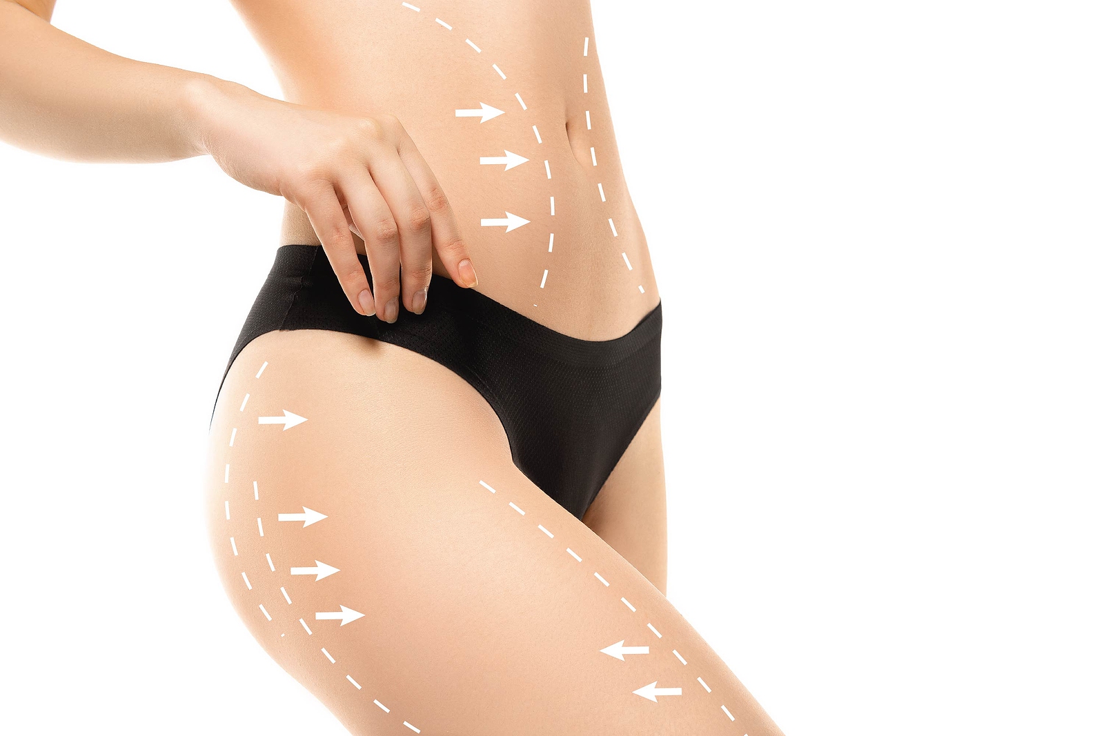best liposuction results