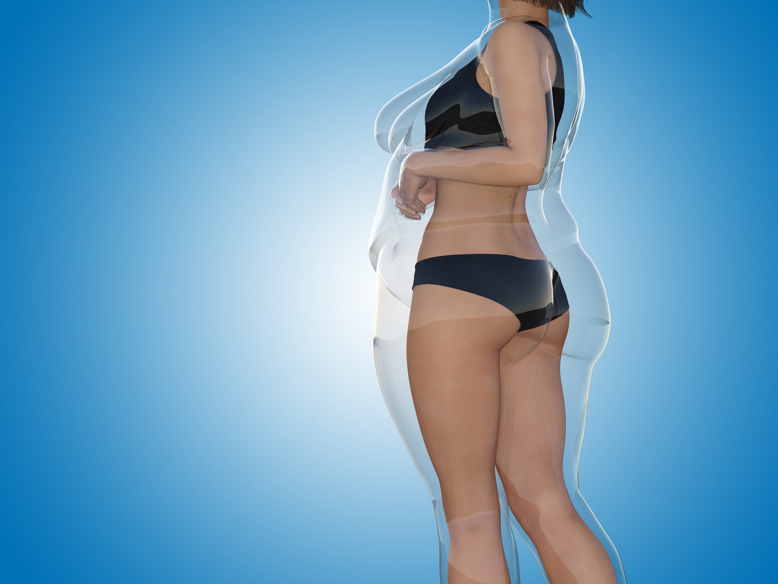 Lipedema treatment