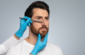 A plastic surgeon drawing marks on a man's nose during a rhinoplasty consultation